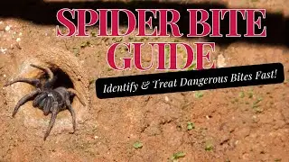 Spider Bite Guide: Identify & Treat Dangerous Bites Fast!