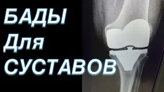 БАДЫ ДЛЯ СУСТАВОВ | Док Ответит
