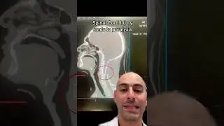 Why Flying Armbar is so DANGEROUS! 