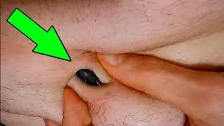 9 Dirtiest Body Parts That We Never Thought Were Dirty