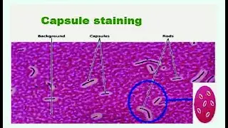 Capsule Stain (India Ink, Nigrosin stain, Anthony's Stain) ; Staining Technique in Microbiology