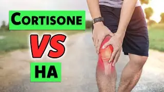 Cortisone vs. Hyaluronic Acid (HA): A Doctor’s Guide to Choosing the BEST Injection