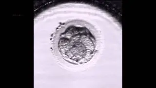 FASES DE UN TRATAMIENTO FIV (Fecundación in vitro): Cultivo embrionario