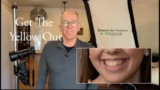 Take The Yellow out of Teeth