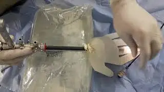 Homemade Nylon Basket Adapted For The Ureteroscope