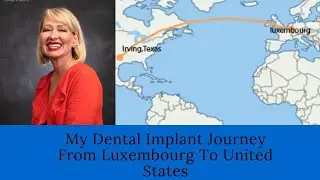 My Dental Implant Journey From Luxembourg To United States