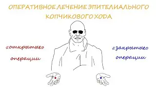 Операции при ЭКХ I  Эпителиально копчиковый ход I пилонидальная киста