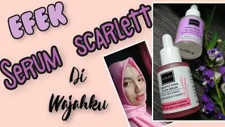 Review serum scarlett