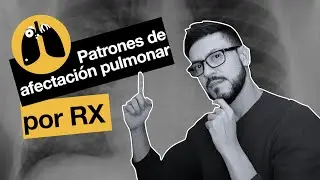 Patrones de afectación pulmonar por radiografía