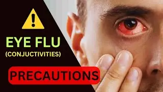 Eye Flu | conjunctivitis | Red eyes | Pink eyes | Eye flu virus | Eye virus