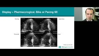Stress Echocardiography