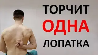 ONE shoulder blade sticks out. A set of exercise therapy exercises against winged shoulder blades