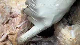 LATERAL CERVICAL REGION Neck Muscles CN11 CERVICAL PLEXUS SCALENE SYNDROME – Sanjoy Sanyal