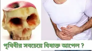 The Most Poisonous Trees in the World,
বিশ্বের সবচেয়ে বিষাক্ত গাছ। 😱