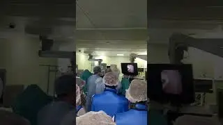 Почкадаги тошни лазер оркали парчалаш 