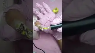 unhas construídas Marmorizada