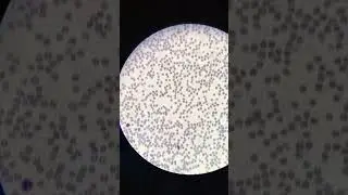 Como contamos as células do sangue 