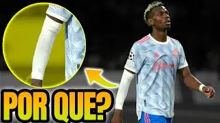POR QUE O POGBA USA ISSO NO BRAÇO?