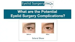 What are the Potential Eyelid Surgery Complications?
