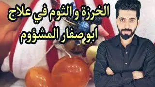 خرزة ابو اصفار و الثوم في علاج ابو صفار بالاطفال !!!