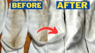 How to Whiten Socks With Peroxide