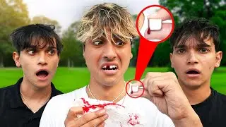 I Got My TOOTH KNOCKED OUT!