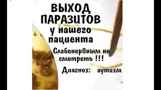 Біздің науқастан ем барысындағы шыққан паразиттер (ішек,бауыр құрттары)