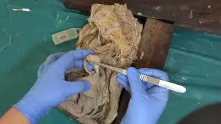 Female Pelvis  Sagittal Section