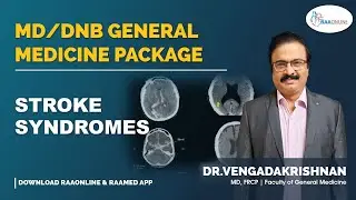 Stroke Syndromes - MD/DNB General Medicine