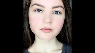 Remove acne scars effortlessly with the best tools in Adobe Photoshop