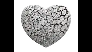Broken heart syndrome aka Takotsubo or Stress cardiomyopathy