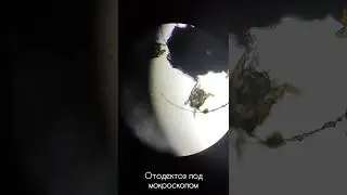 Ушной клещ (отодектоз) под микроскопом.