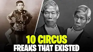 10 circus freaks that existed