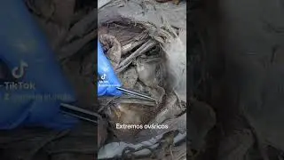 El ovario humano con sus extremos tubárico y uterino
