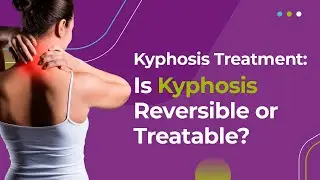 Kyphosis Treatment: Is Kyphosis Reversible or Treatable?