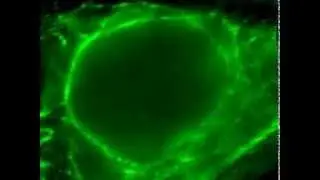 OMX 3D Structured Illumination Microscopy (3D-SIM) acquisition