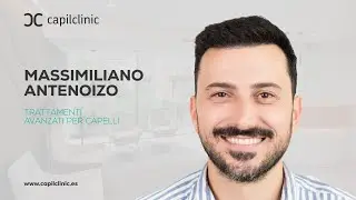 Trapianto di capelli in Italia e in Turchia: l’esperienza di Massimiliano con Capilclinic
