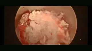 Перкутанные методики