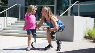 How to Get a Prosthetic Leg