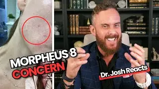 My Morpheus8 Nightmare: Dr. Josh Reacts!