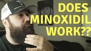 Is Minoxidil SAFE for a patchy beard? | Things you NEED to know