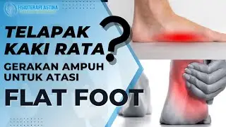 Cara Mengatasi Telapak Kaki Datar | FLAT FOOT | Kaki Bebek Fisioterapi