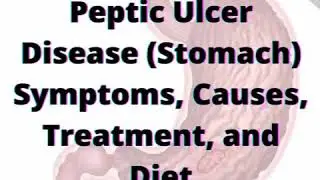 Peptic Ulcer Disease (Stomach): Symptoms, Causes, Treatment