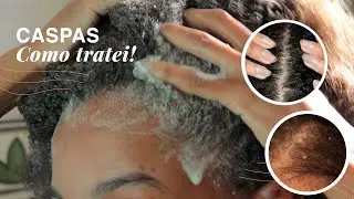 CASPAS | Como tratei! @jec0sta