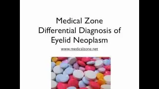 Medical Zone - Differential Diagnosis of Eyelid Neoplasm