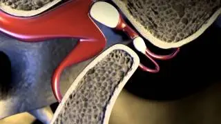 3D Medical Animation - Temporomandibular Joint || ABP ©