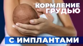 Можно ли кормить грудью после увеличения груди | Можно ли кормить грудью после уменьшения груди?