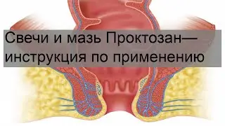 Свечи и мазь Проктозан— инструкция по применению