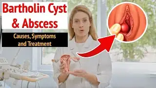 Understand Bartholin Cysts and Abscesses