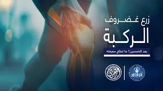 انا والدكتور | زرع غضروف الركبة بعد الخمسين